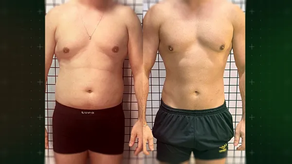 Antes e Depois